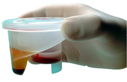 Safety of Platelet-Rich Plasma